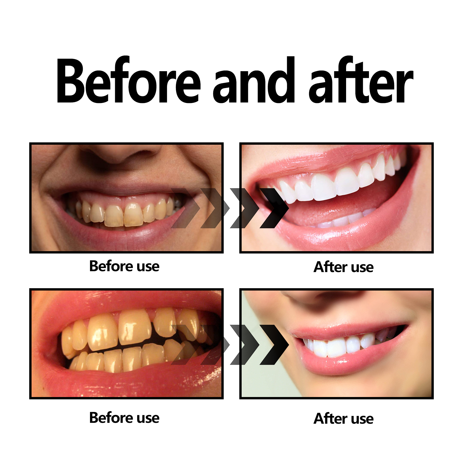 Activated Coconut Charcoal Too - огляд і ціна Teeth Whitening With Coconut Oil