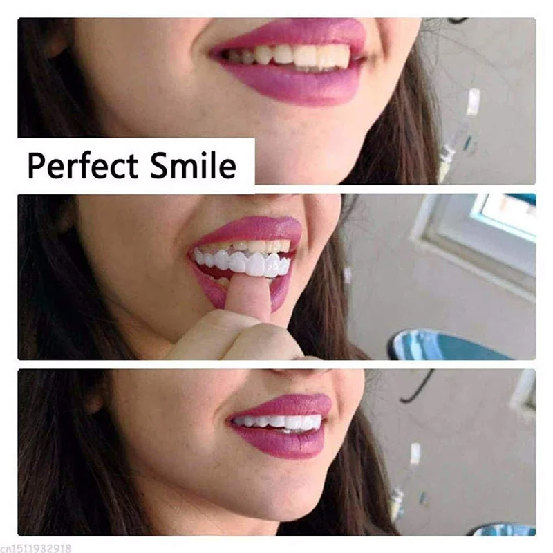 Veneer Snap-on Teeth Kit Fake  - огляд і ціна Teeth Whitening Session