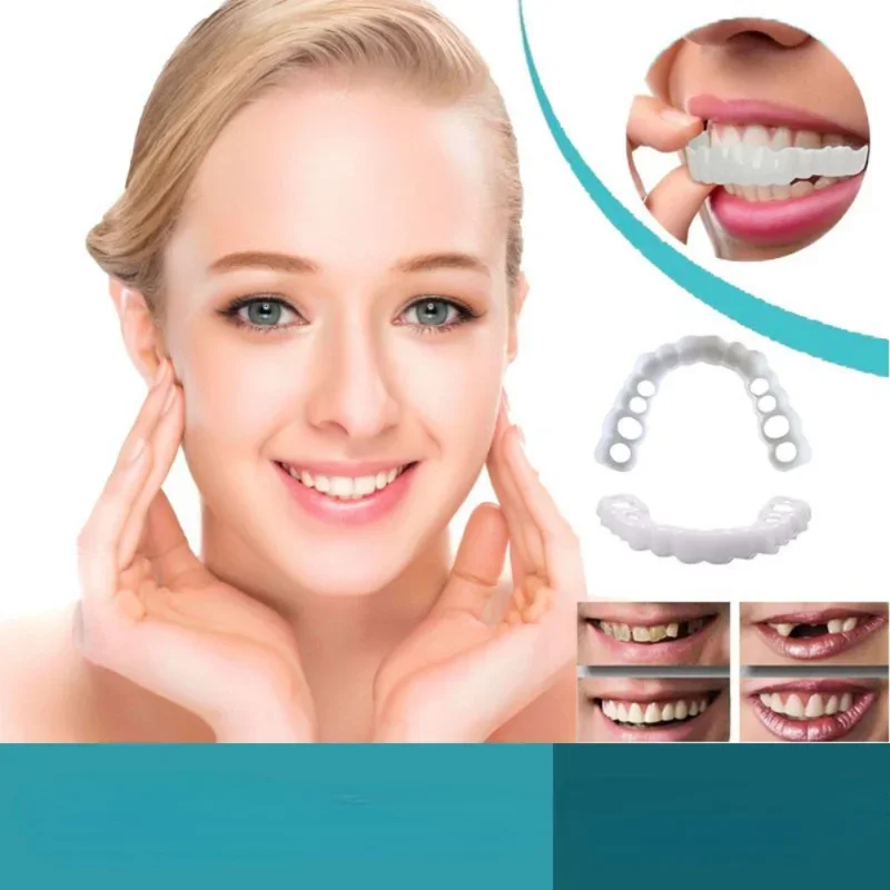 Denture Cover Veneer Snap-on T - огляд і ціна Teeth Whitening Session
