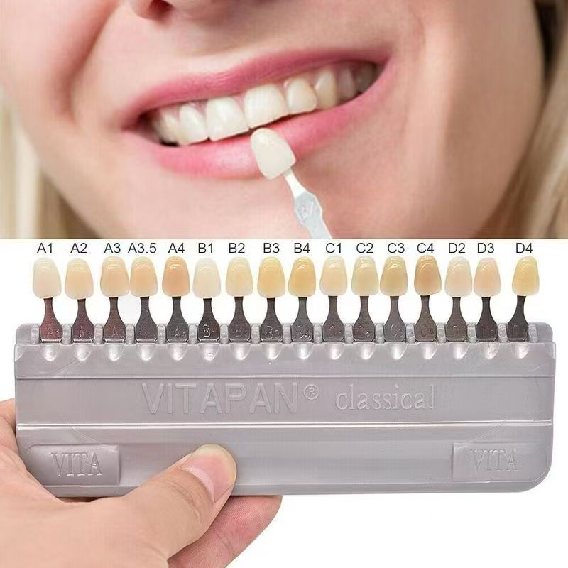 VITA 16 Colors Teeth Shade Gui - огляд і ціна Teeth Whitening Express