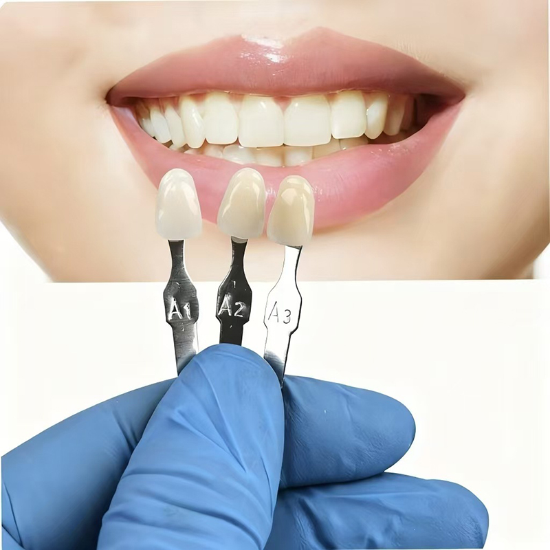 VITA 16 Colors Teeth Shade Gui - огляд і ціна Teeth Whitening Express