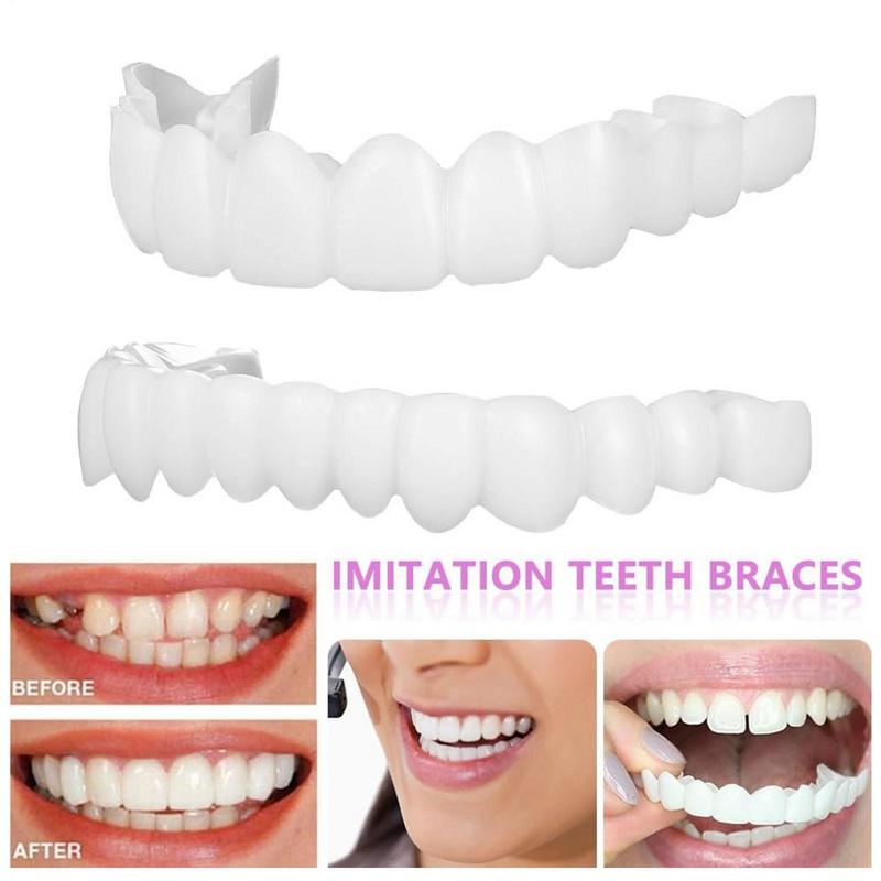 Snap On Teeth Veneers Instant  - огляд і ціна Teeth Whitening Instant