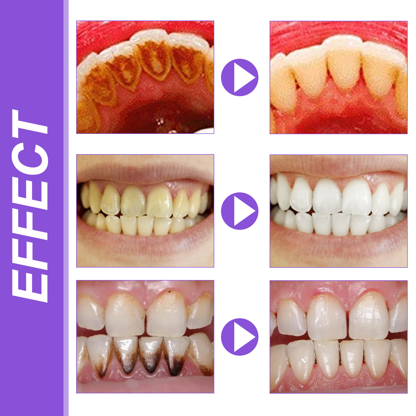 EELHOE Smiles Bright White Ref - огляд і ціна Teeth Whitening Serum