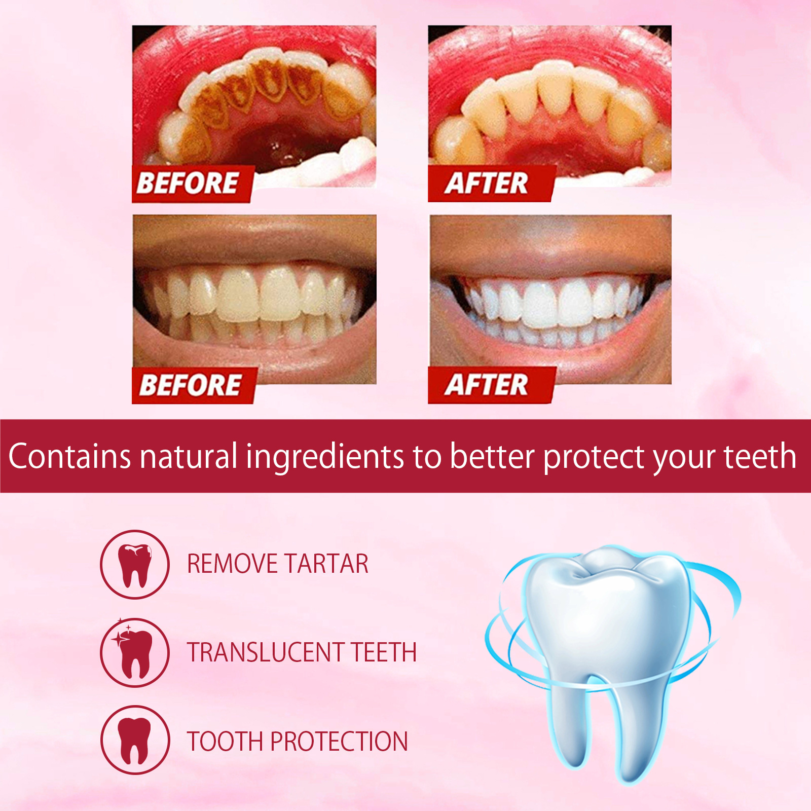 120g Probiotic Whitening Tooth - огляд і ціна Teeth Whitening With Coconut Oil
