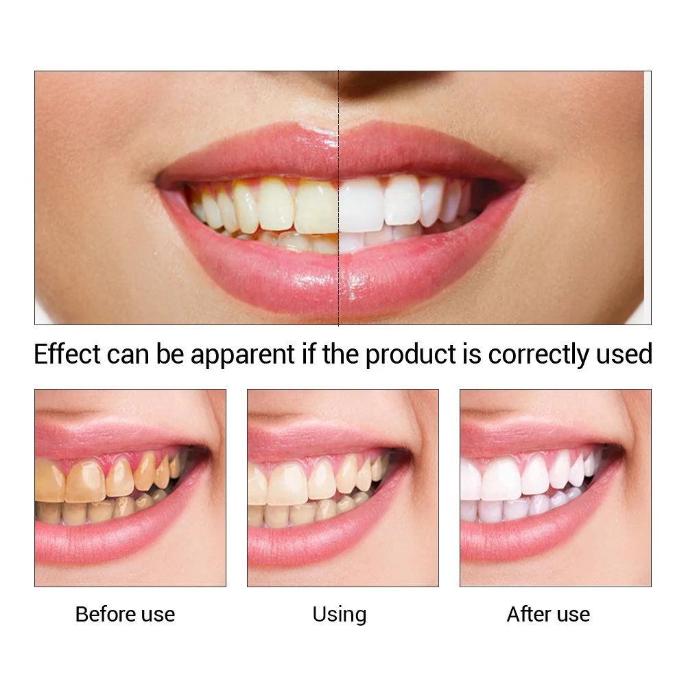 FTEENPLY Teeth Whitening Essen - огляд і ціна Teeth Whitening Serum