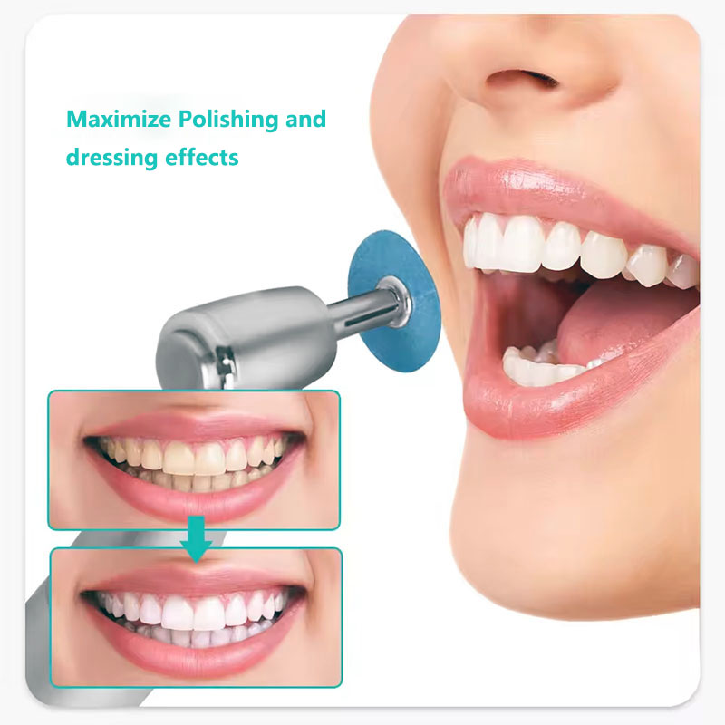 40pcs Dental Polishing Discs H - огляд і ціна Teeth Whitening Express