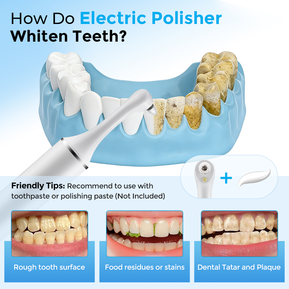 Electric Tooth Polisher Teeth  - огляд і ціна Teeth Whitening Led Light