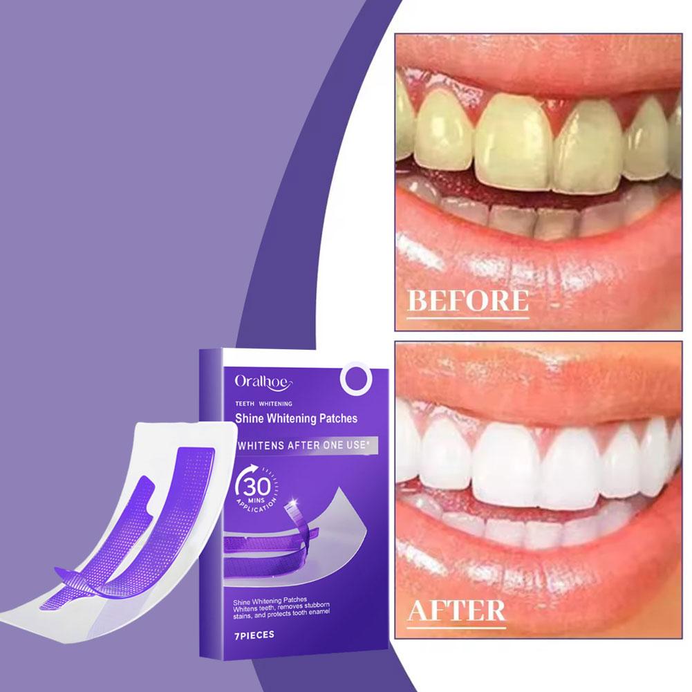 Purple Teeth Whitening Strips  - огляд і ціна Teeth Whitening Strips Crest