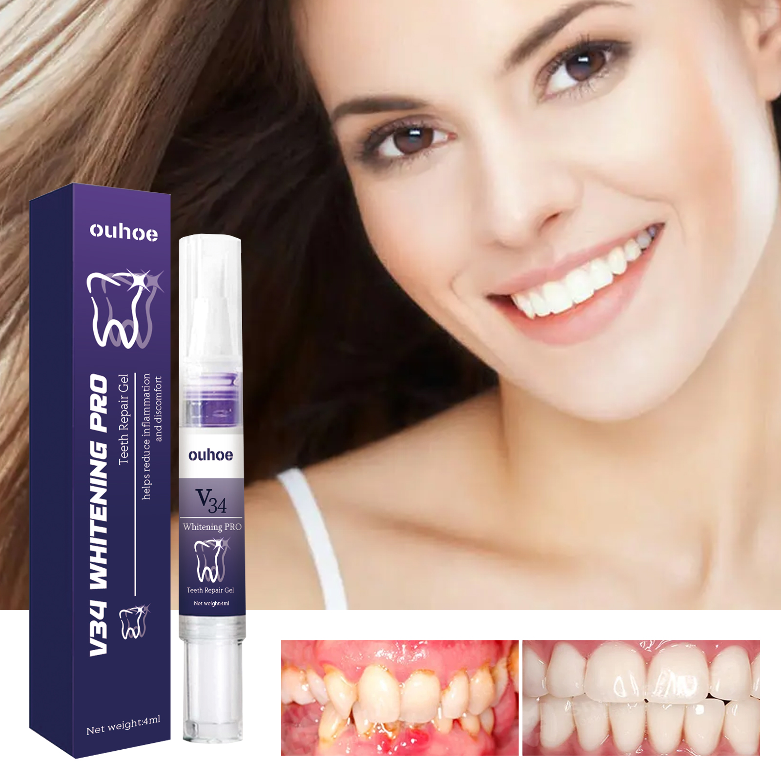 Rapid Repair Damaged Gums Gel  - огляд і ціна Teeth Whitening Serum