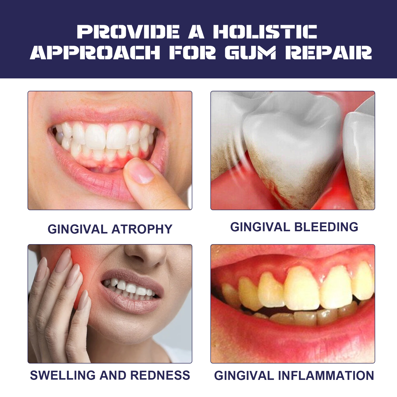 Rapid Repair Damaged Gums Gel  - огляд і ціна Teeth Whitening Serum