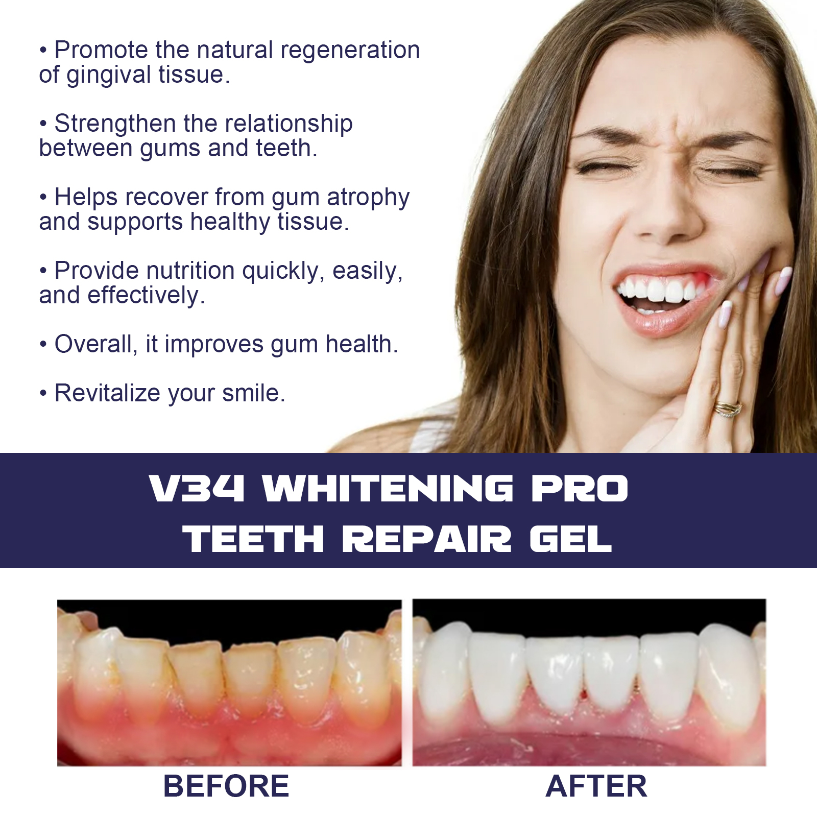 Rapid Repair Damaged Gums Gel  - огляд і ціна Teeth Whitening Serum