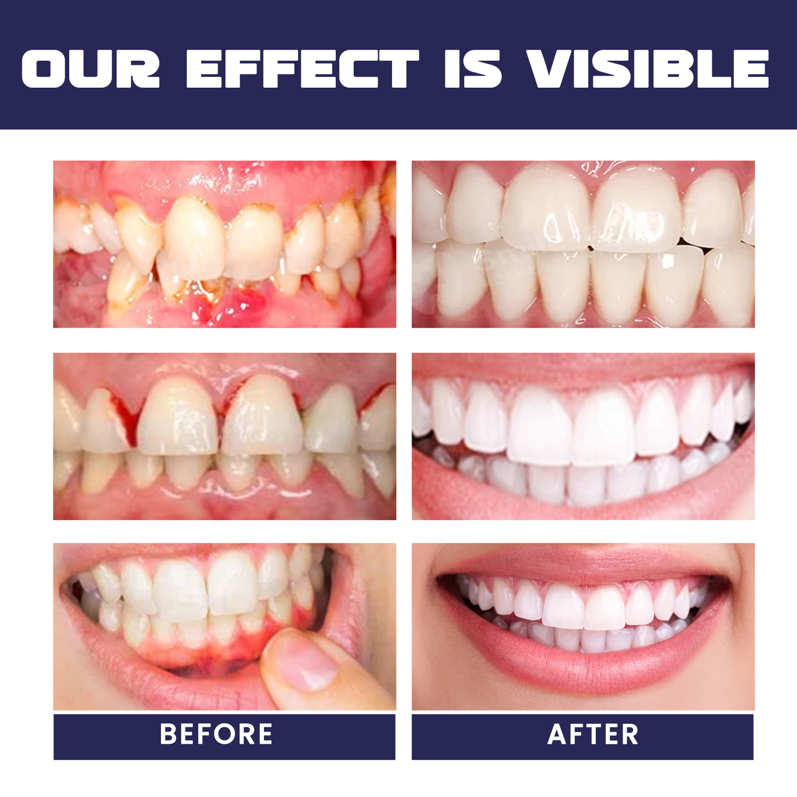Rapid Repair Damaged Gums Gel  - огляд і ціна Teeth Whitening Serum