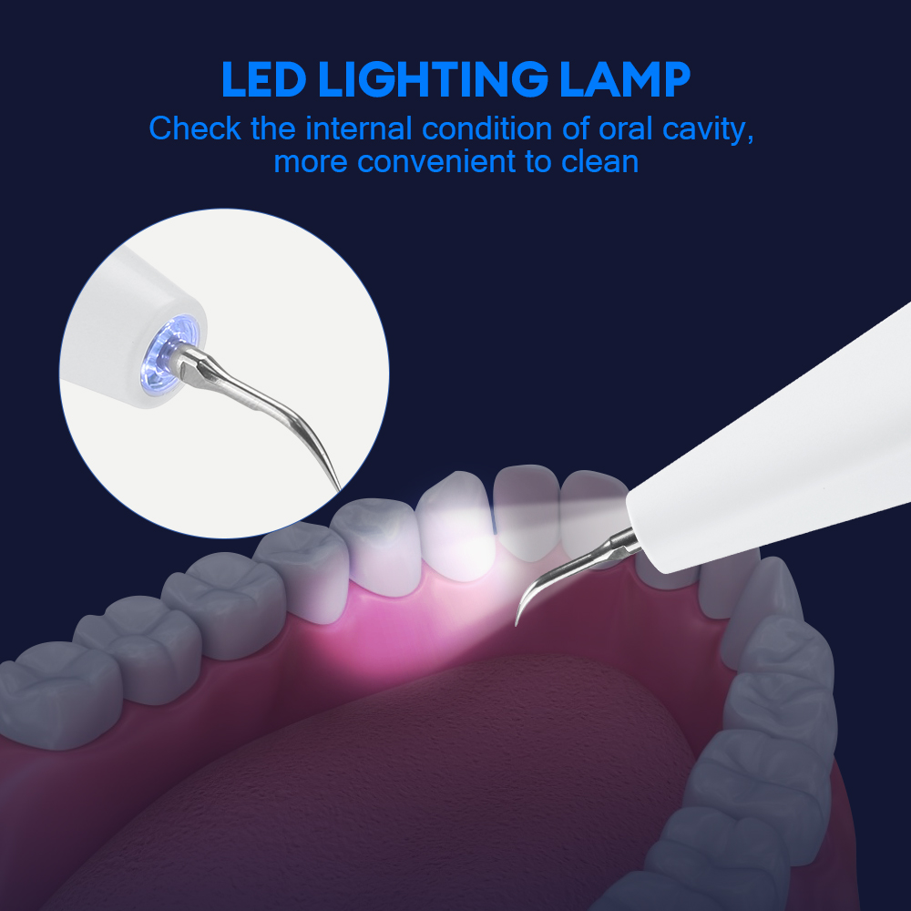 Ultrasonic Dental Calculus Rem - огляд і ціна Teeth Whitening Express