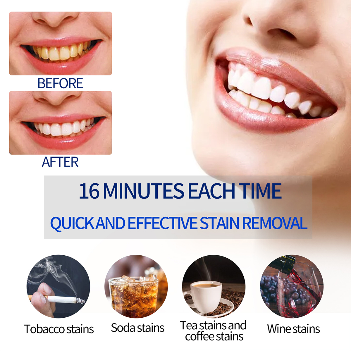 Portable Teeth Whitening Lamp  - огляд і ціна Teeth Whitening Session