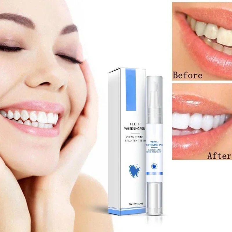 Teeth Whitening Pen Cleaning S - огляд і ціна Teeth Whitening Serum
