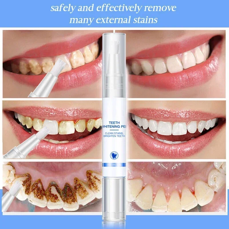 Teeth Whitening Pen Cleaning S - огляд і ціна Teeth Whitening Serum