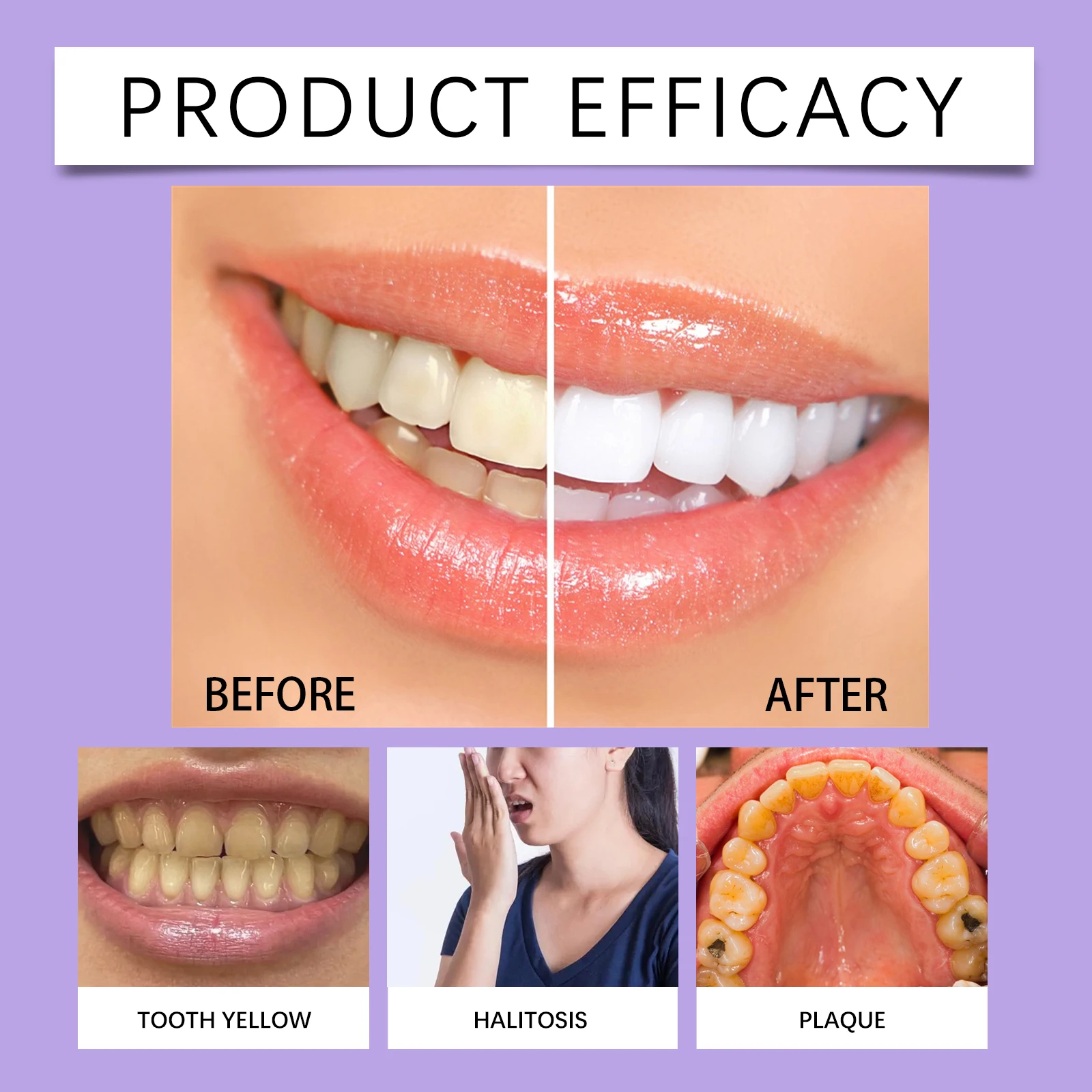 Teeth Whitening Pen Teeth Gel  - огляд і ціна Teeth Whitening Serum