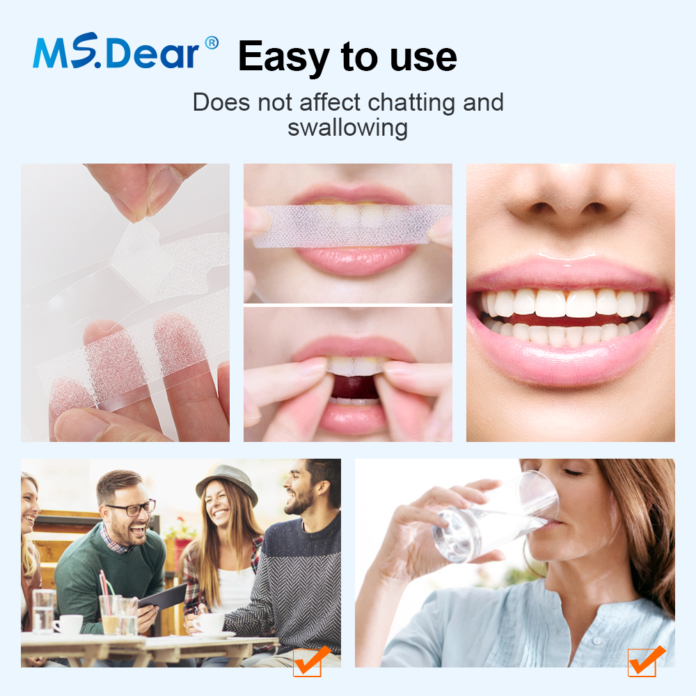 Teeth Whitening Strips Cleansi - огляд і ціна Teeth Whitening Strips Crest